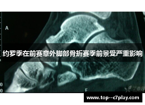 约罗季在前赛意外脚部骨折赛季前景受严重影响 约罗季在前赛意外脚部骨折赛季前景受严重影响